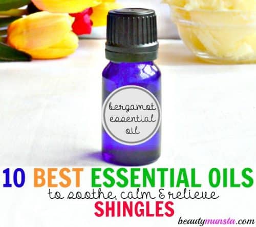 10 Best Essential Oils for Shingles Itch, Rash &  Nerve Pain ...