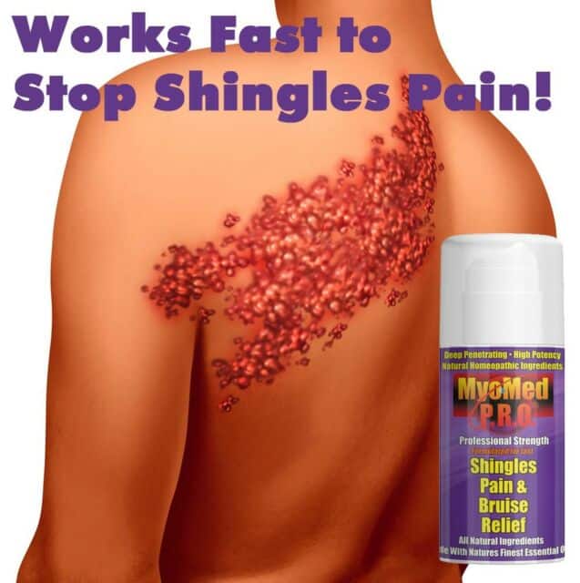 Best Shingles Treatment Cream for Pain Relief Essential Oil Topical Q3 ...