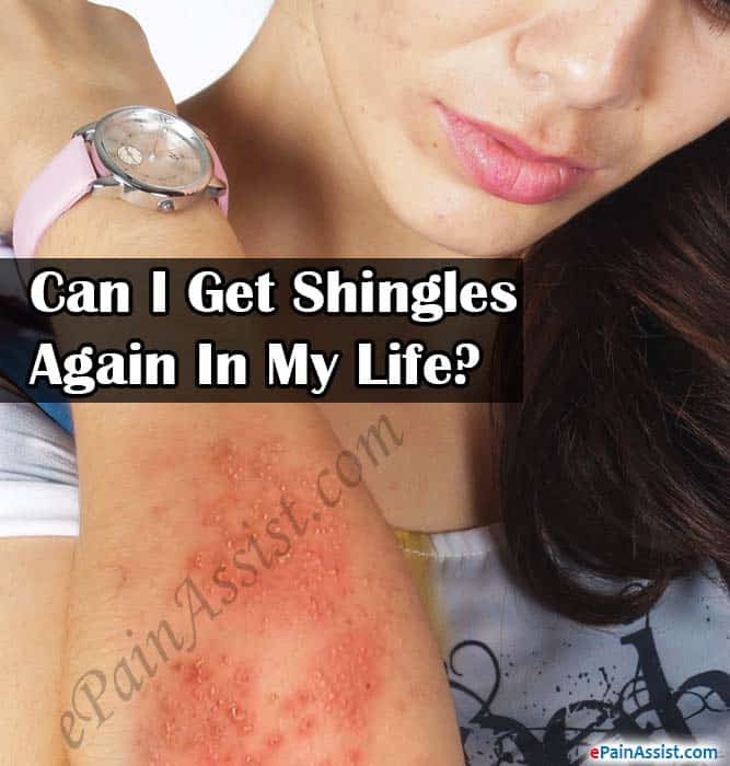 Can I Get Shingles Again In My Life?