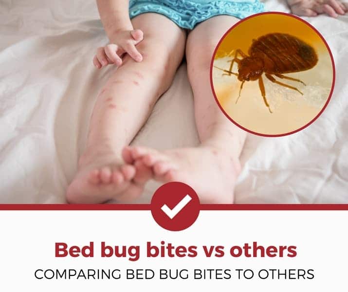 Do Bedbug Bites Look Like Shingles