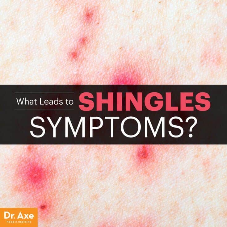 If You Have These Symptoms, You May Have Shingles
