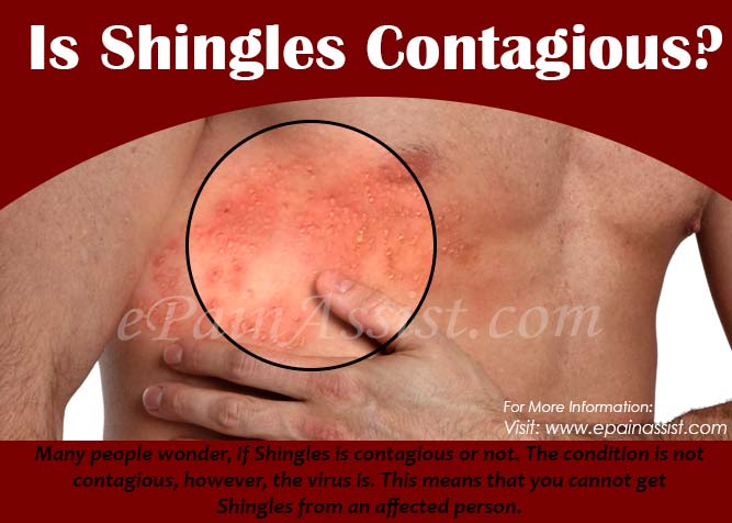 Is Shingles Contagious &  How Long Does it Last?