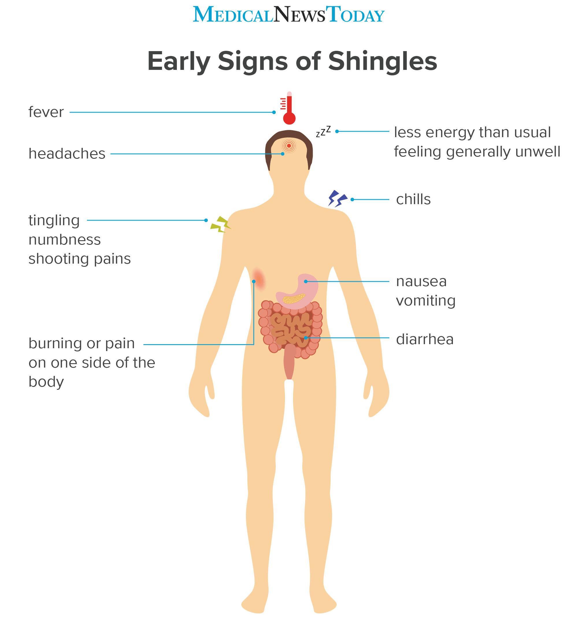 Medical News Today: What are the early signs and symptoms of shingles ...