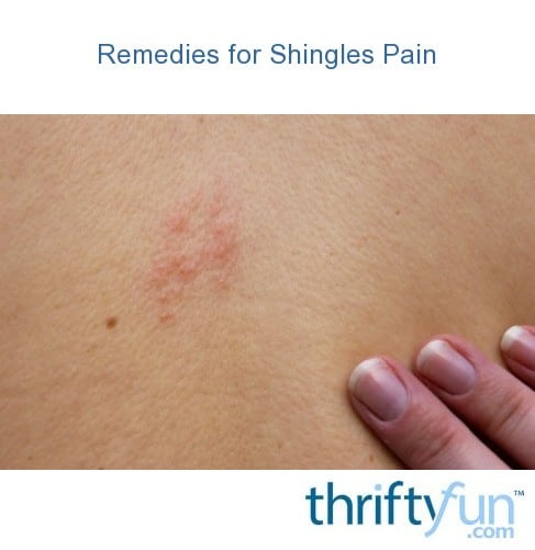 Remedies for Shingles Pain
