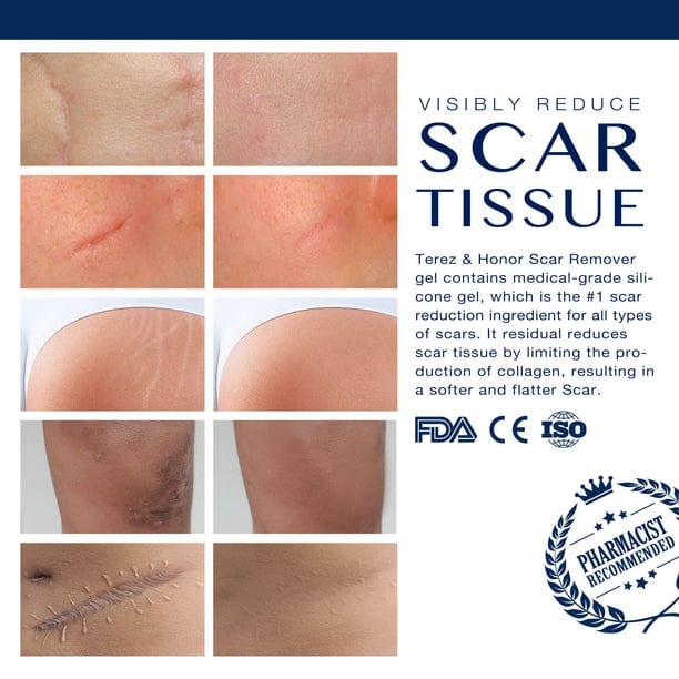 Scar Remover Gel for Scars from C