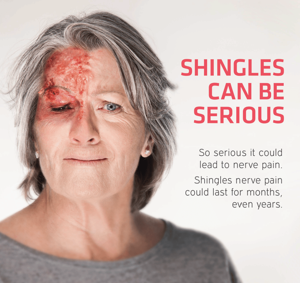 Shingles face  Mandurah Medical