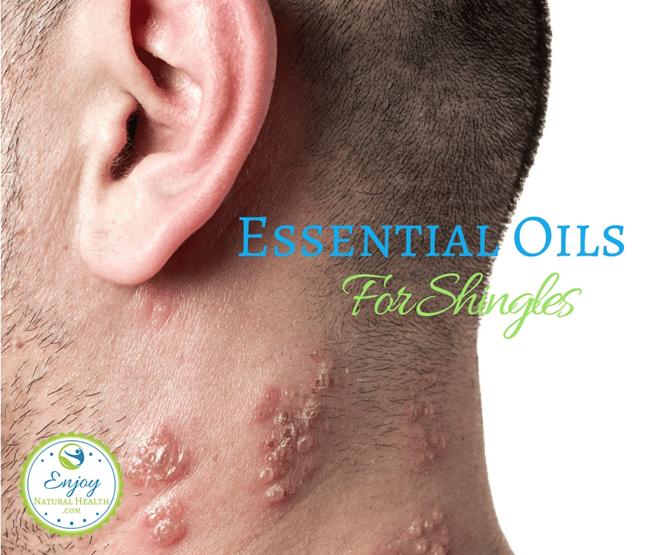 What Does Shingles Look Like On Your Neck