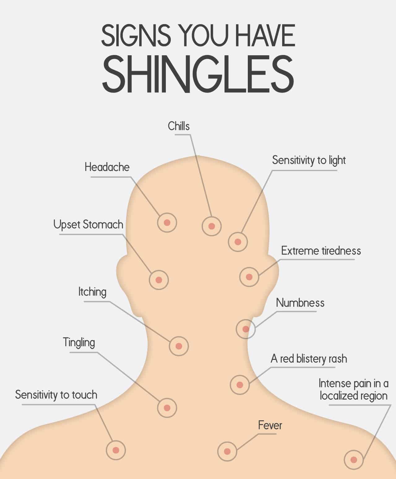 What Is Shingles: Causes, Symptoms and Contagiousness  The Amino Company
